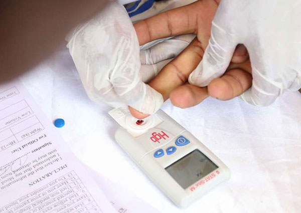 AIDS testing