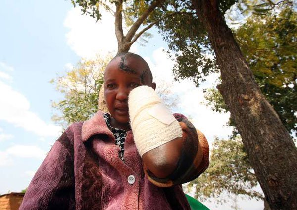 Battered woman says she stayed on to save marriage